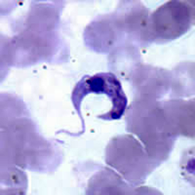 Trypanosoma Cruzi Caracter Sticas Ciclo De Vida Enfermedades S Ntomas